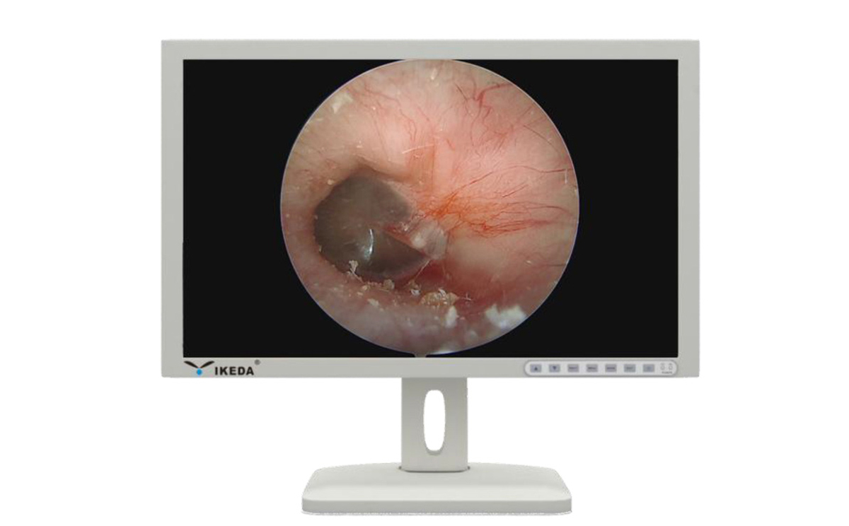 內(nèi)窺鏡監(jiān)視器功能特點 內(nèi)窺鏡監(jiān)視器功能特點
