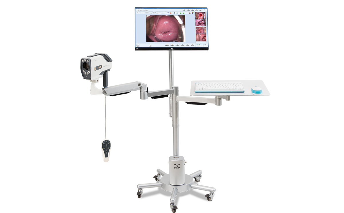 數(shù)碼電子陰道鏡如何選擇？根據(jù)醫(yī)院等級(jí)需求選擇合適的