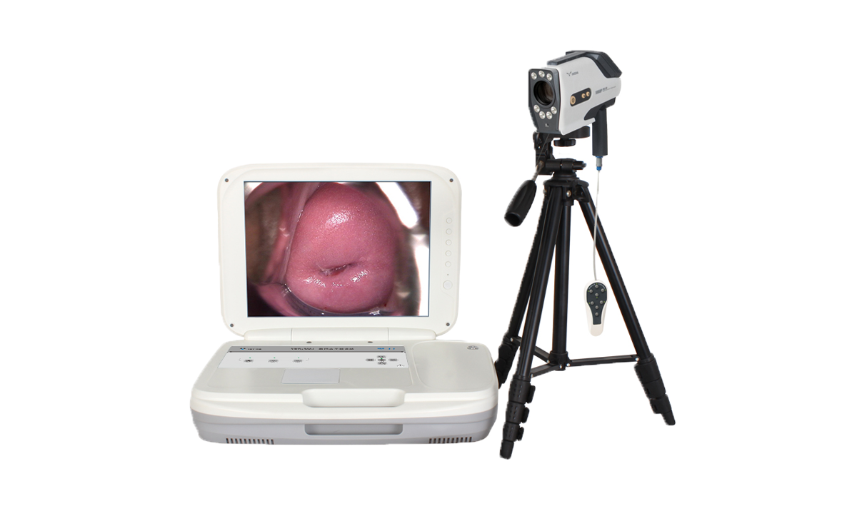 數(shù)碼電子陰道鏡如何選擇？根據(jù)醫(yī)院等級(jí)需求選擇合適的