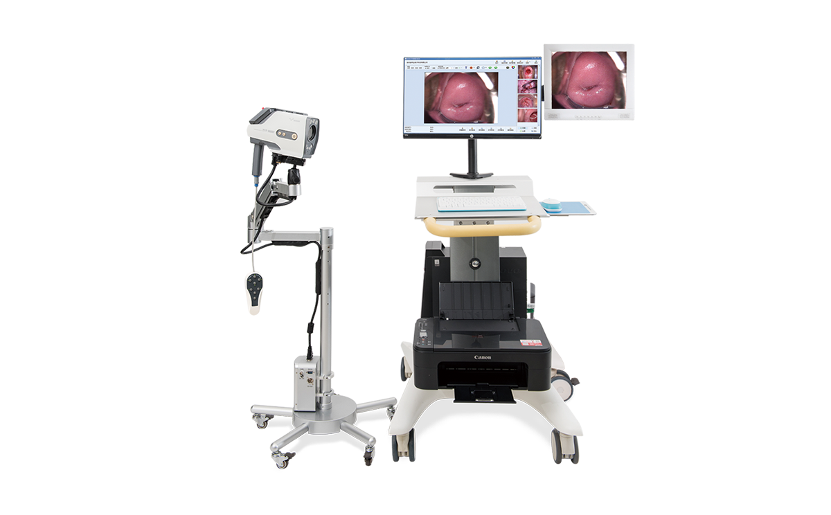 數(shù)碼電子陰道鏡如何選擇？根據(jù)醫(yī)院等級(jí)需求選擇合適的