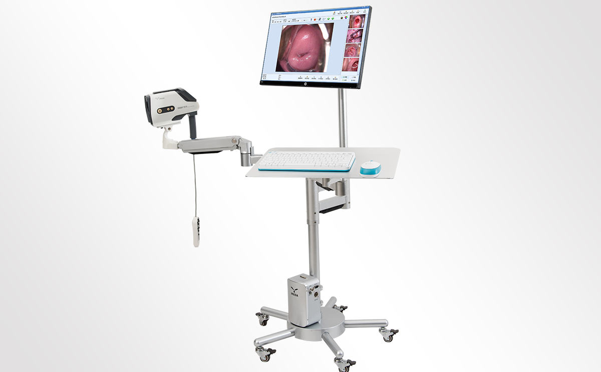 陰道鏡廠家：哪里可以買到陰道鏡？陰道鏡價格？