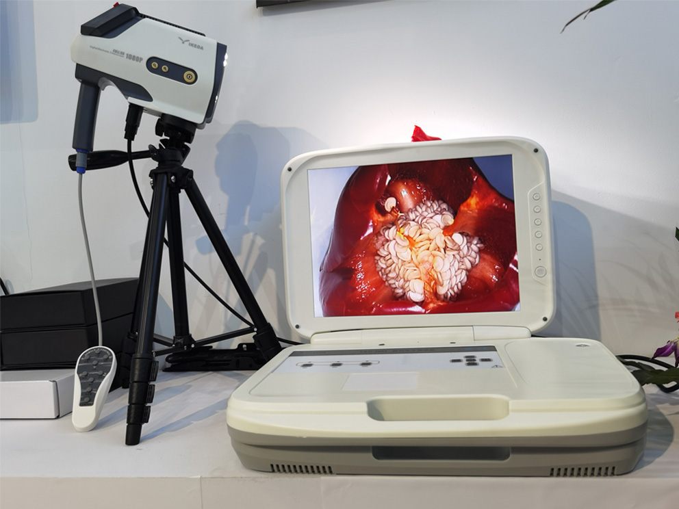 陰道鏡檢查：電子陰道鏡檢查過程疼嗎？