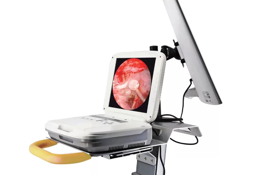 人手一鏡！從容應對各種內(nèi)窺領域