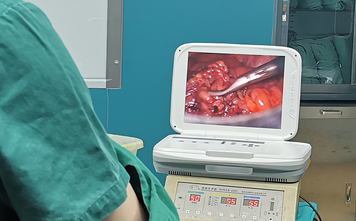 【腹腔鏡篇】腹腔鏡疝氣手術(shù)，您知道嗎？