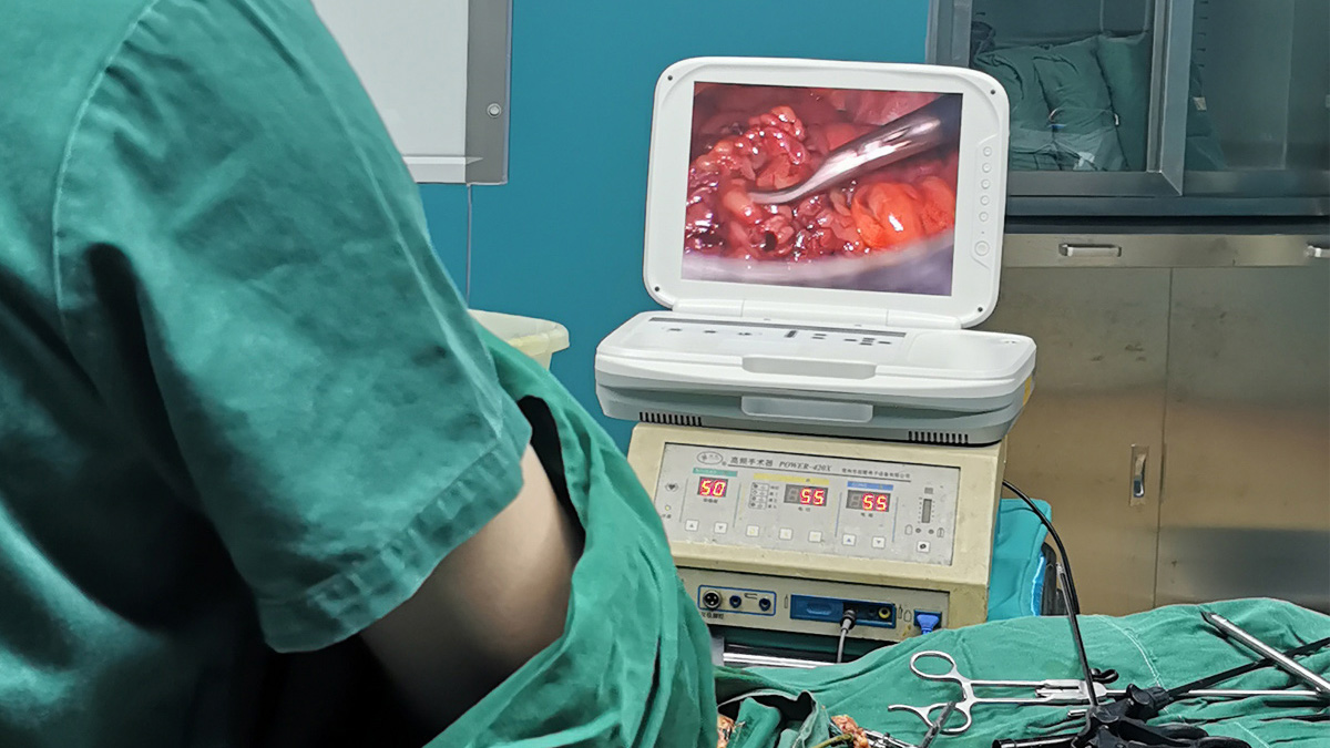 內(nèi)窺鏡攝像機(jī)適用于哪些科室范圍？