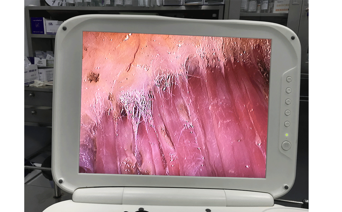 內(nèi)窺鏡廠家與您分享內(nèi)窺鏡輔助的整形手術(shù) 內(nèi)窺鏡廠家與您分享內(nèi)窺鏡輔助的整形手術(shù)