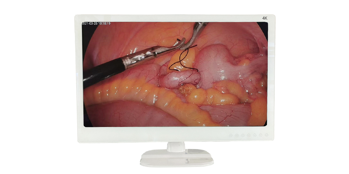 內(nèi)窺鏡監(jiān)視器日常維護保養(yǎng)應注意哪些？