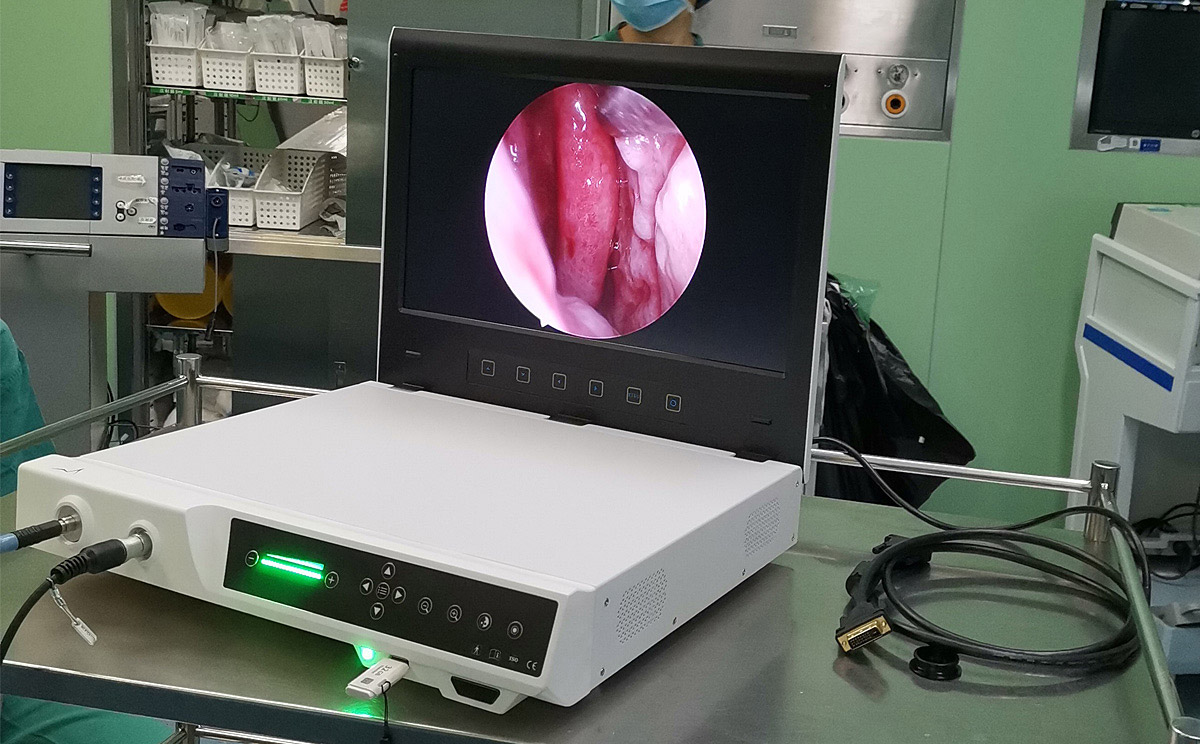 內(nèi)窺鏡攝像系統(tǒng)