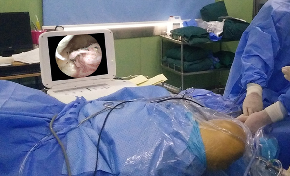 如何保養(yǎng)維護(hù)關(guān)節(jié)鏡？