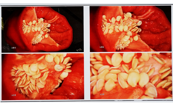 電子陰道鏡放大倍率是多少？