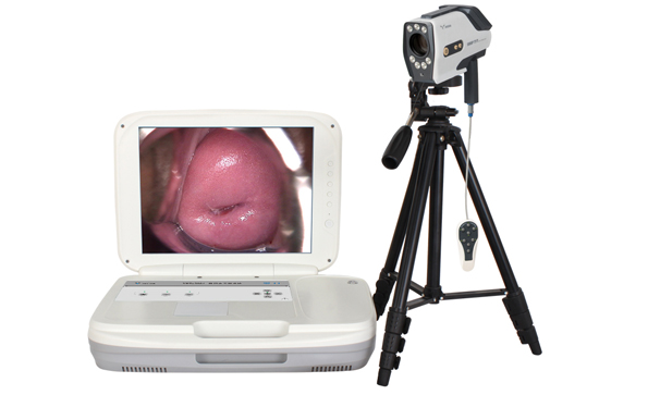 電子陰道鏡最低像素多少？