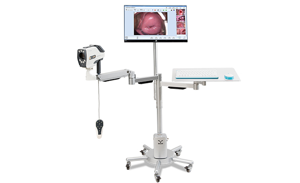 數(shù)碼電子陰道鏡如何選擇？根據(jù)醫(yī)院等級(jí)需求選擇合適的