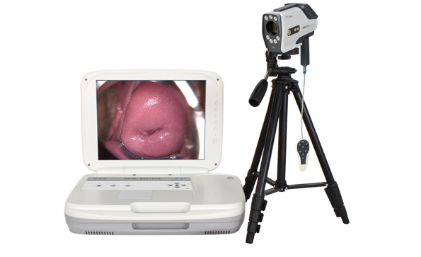 電子陰道鏡檢查都要取活檢嗎？