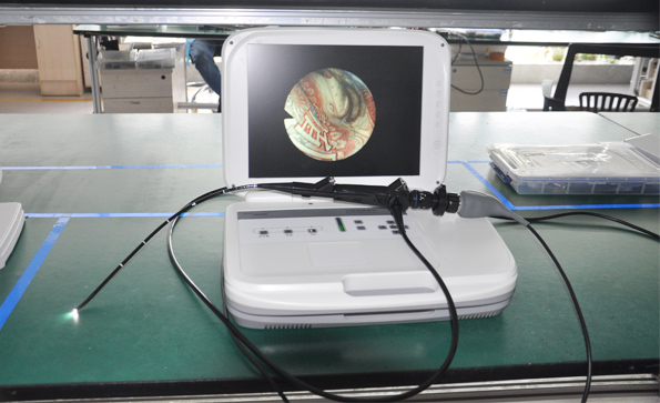 耳鼻喉內(nèi)窺鏡怎樣檢查咽喉？