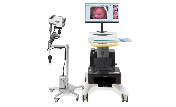 婦科電子陰道鏡檢查的作用有哪些？