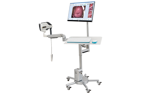 電子陰道鏡檢查結(jié)果有哪些？多長時間出結(jié)果？