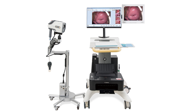 電子陰道鏡廠家介紹：電子陰道鏡使用過程容易出現(xiàn)哪些問題？