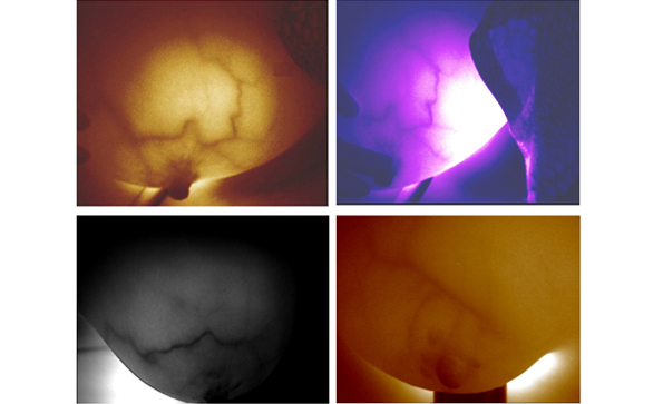 紅外乳腺檢查儀檢查乳腺準(zhǔn)嗎？如何檢查呢？