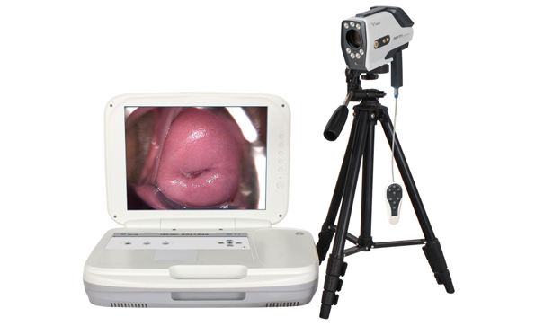 陰道鏡廠家：什么情況下要做陰道鏡？需要注意哪些？