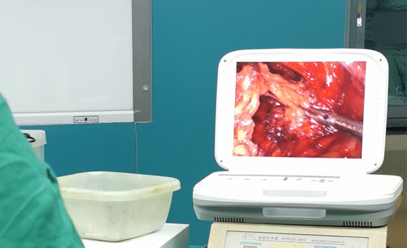 【腹腔鏡篇】腹腔鏡疝氣手術(shù)，您知道嗎？