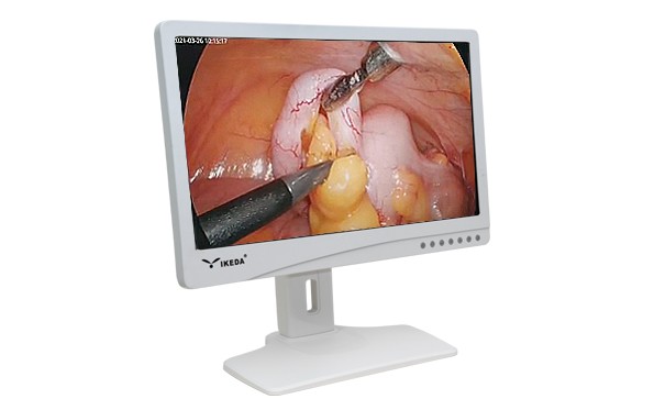 醫(yī)用顯示器與普通顯示器有哪些區(qū)別？