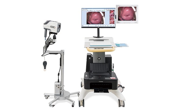 重視陰道鏡檢查的原因是什么？