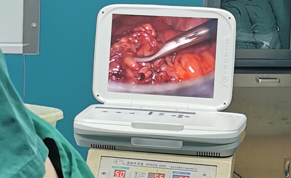 腹腔鏡檢查是怎么做的？