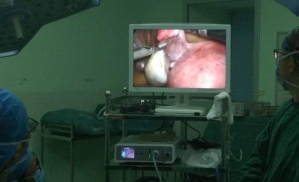 宮腔鏡和腹腔鏡有哪些區(qū)別呢？